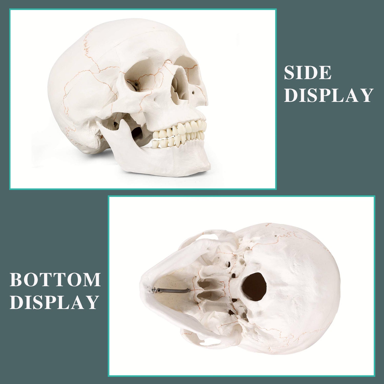 RONTEN Life Size Human Skull Model Hand-Painted in Color Suture Line Skull Model Display