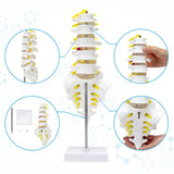Lumbar Spine Model Lumbosacral Segment Model with A Herniated Disc 