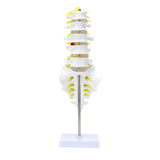 RONTEN Lumbar Spine Model Lumbosacral Segment Model with A Herniated Disc At L4 and Spinal Nerves