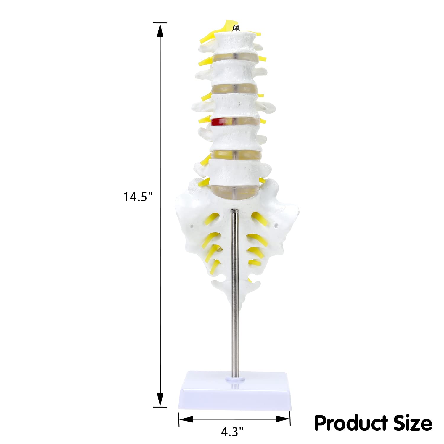 RONTEN Lumbar Spine Model Lumbosacral Segment Model with A Herniated Disc At L4 and Spinal Nerves Size