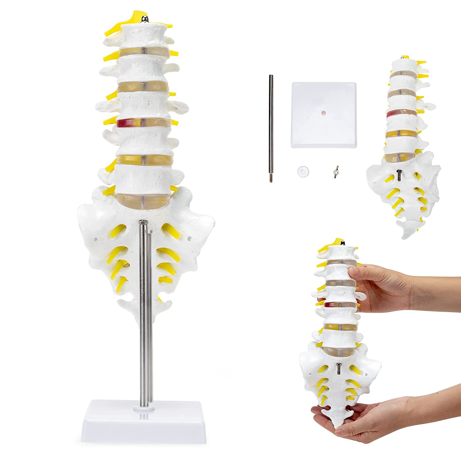 RONTEN Lumbar Spine Model Lumbosacral Segment Model with A Herniated Disc