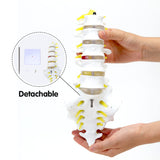 Lumbar Spine Model Lumbosacral Segment Model with A Herniated Disc At L4 and Spinal Nerves