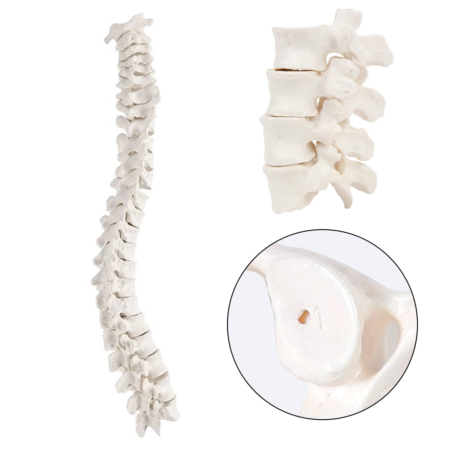 spine model