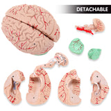 Detachable Brain Model