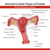 RONTEN Human Female Uterus Ovary Model Anatomical Bilateral Ovarian Uterus Model