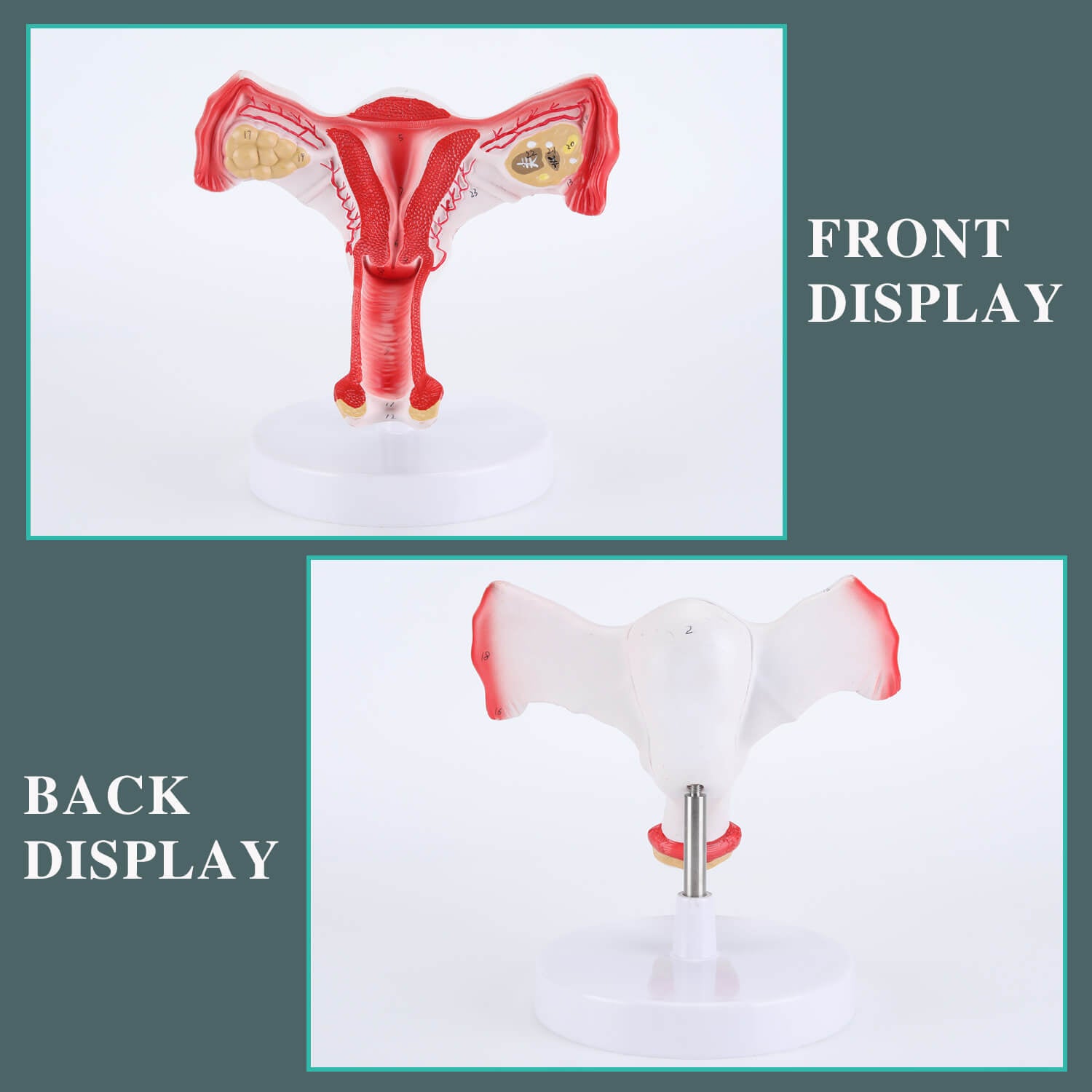 RONTEN,Human Female Uterus Ovary Model,Anatomical Bilateral Ovarian Uterus Model,anatomy models, anatomical models, medical education models,display model