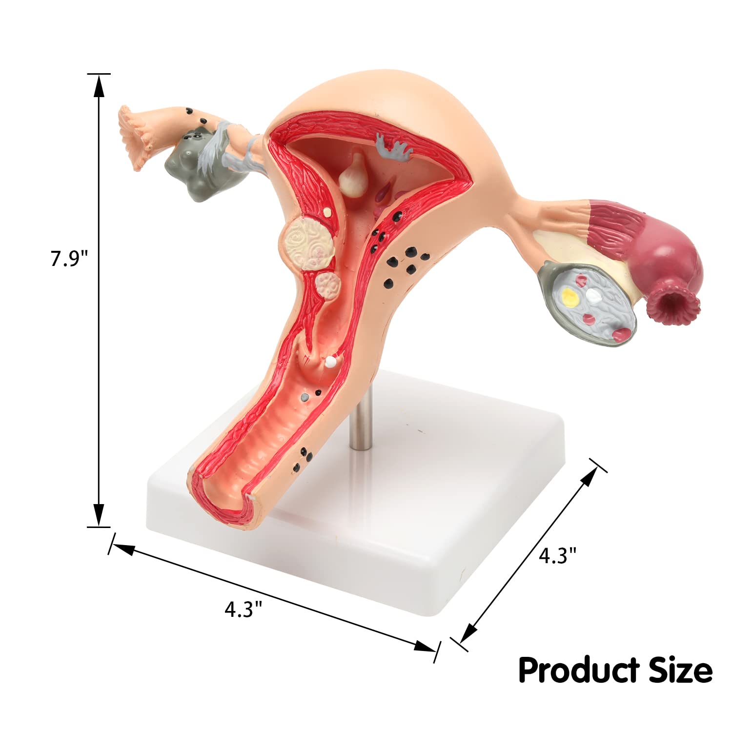 RONTEN Human Uterus and Ovary Model Pathological Uterus Anatomical Model SIZE