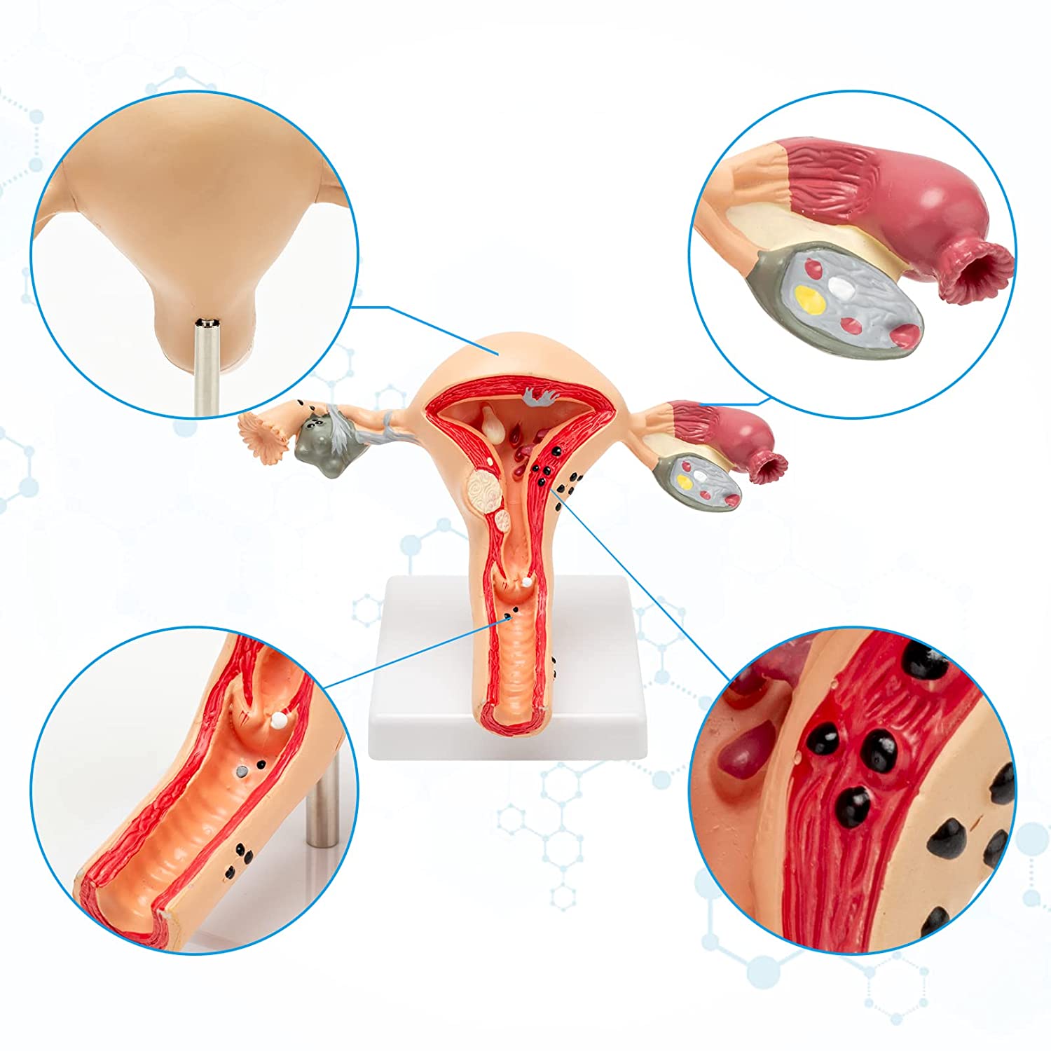 RONTEN Human Uterus and Ovary Model Pathological Uterus Anatomical Model Display
