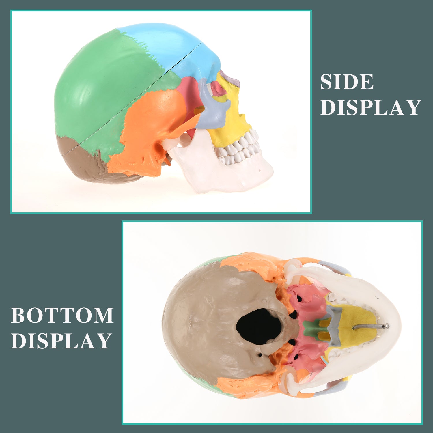 RONTEN Human Skull Anatomical Model Painted Medical Skull Model