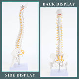 RONTEN 15.5" Human Mini Spine Model Mini Vertebral Column Model